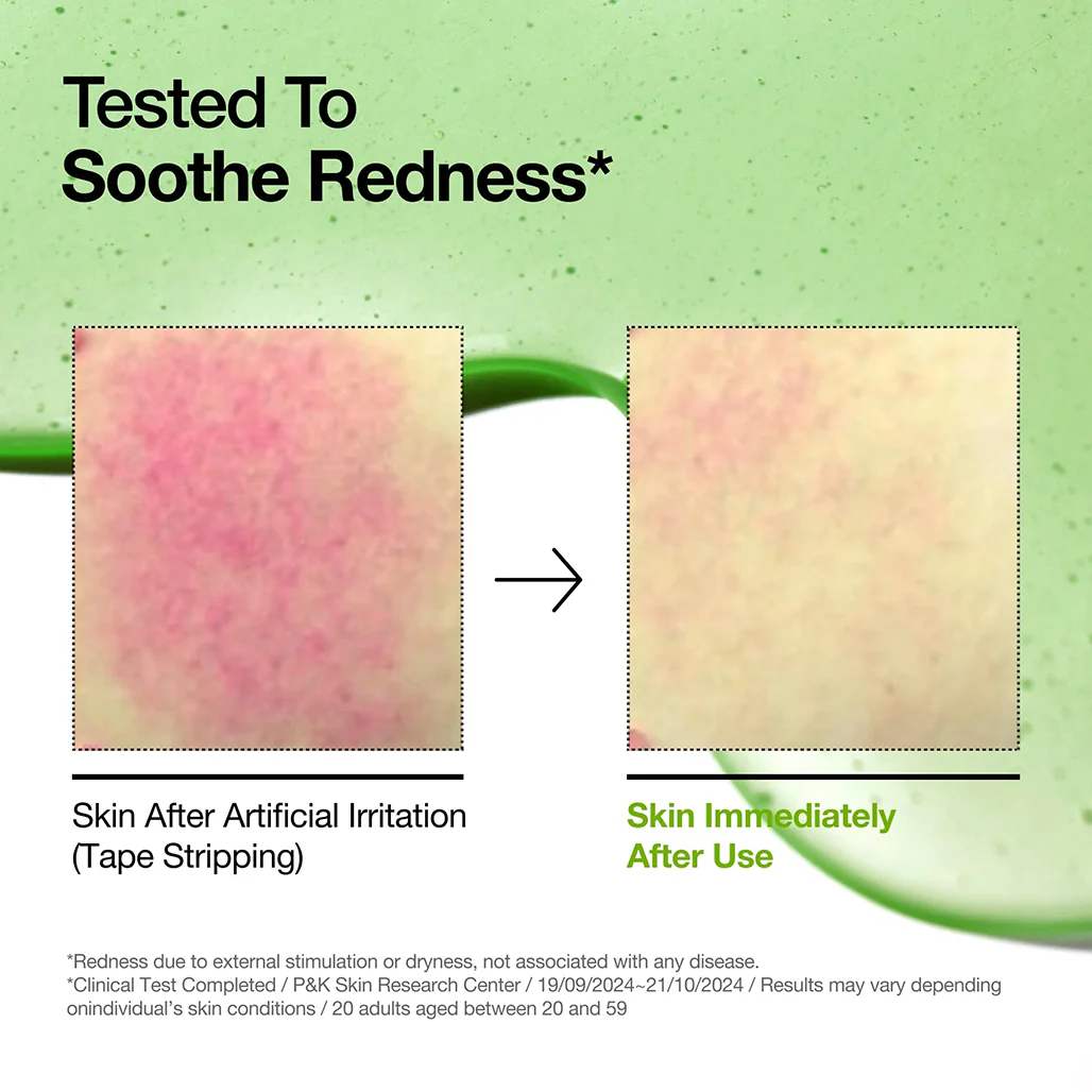 Anua Azelaic Acid 10+ - Hyaluron Redness Soothing Serum - Image 10