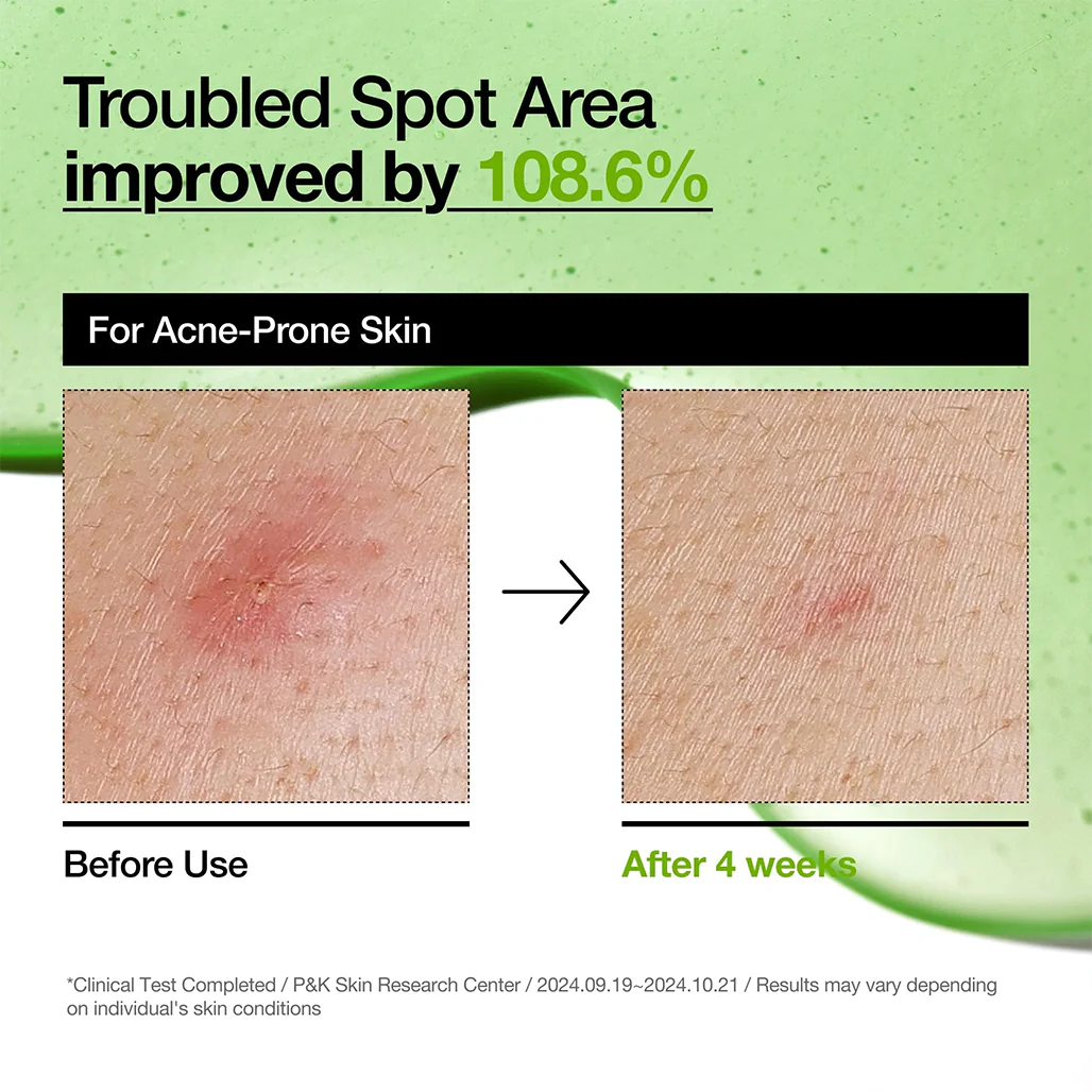 Anua Azelaic Acid 10+ - Hyaluron Redness Soothing Serum - Image 9